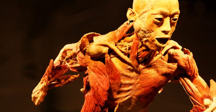real bodies sportpaleis antwerpen expo lichaam korperwelten rariteitenkabinet wunderkammer geslachtsziekten tento lichaam (2)